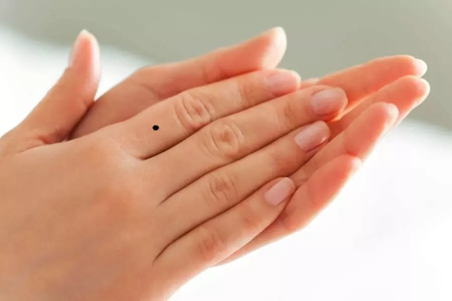 Người có nốt ruồi trên ngón tay thường khá kỹ tính